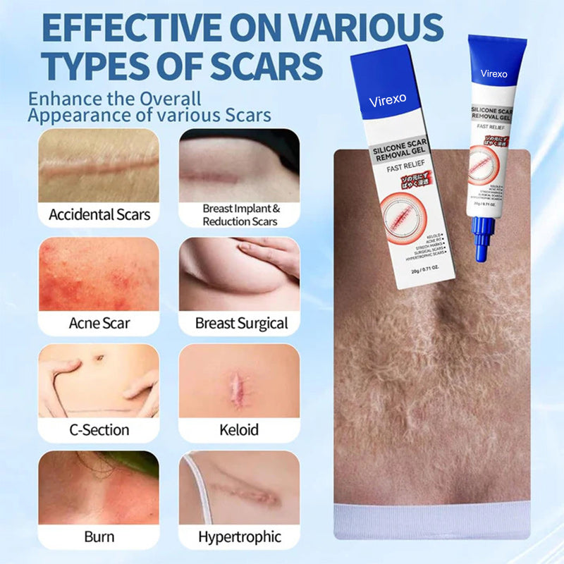 Virexo®Silicone Scar Gel for Old & New Scars — Lightweight, Fast-Absorbing Care for Face & Body