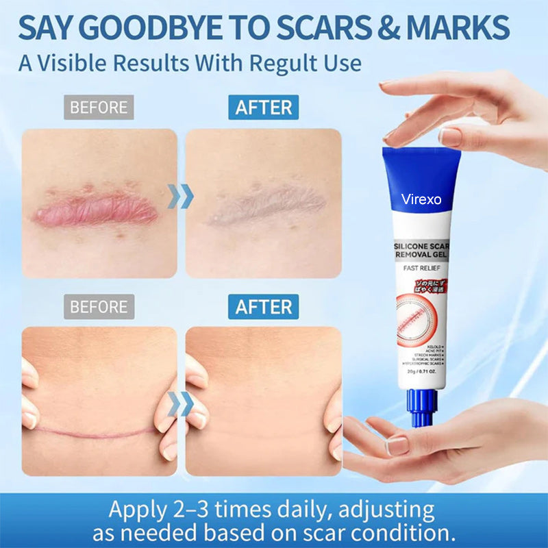 Virexo®Silicone Scar Gel for Old & New Scars — Lightweight, Fast-Absorbing Care for Face & Body